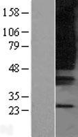 OXGR1 Human Over-expression Lysates NM_080818