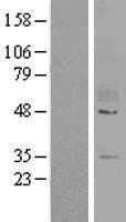 GPR78 Human Over-expression Lysates NM_080819