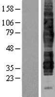 C5L2 (C5AR2) Human Over-expression Lysates NM_018485