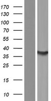 SULT1C4 Human Over-expression Lysates NM_006588