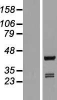 ls027236 arfip1 human over expression lysates nm 001025593 wb testing 1