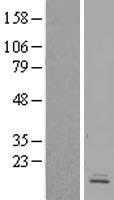GPR162 Human Over-expression Lysates NM_014449