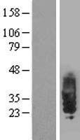 SIT (SIT1) Human Over-expression Lysates NM_014450