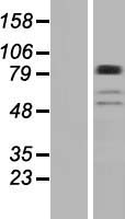BBS9 Human Over-expression Lysates NM_198428
