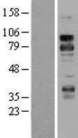DR6 (TNFRSF21) Human Over-expression Lysates NM_014452