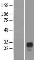 CHMP2A Human Over-expression Lysates NM_014453