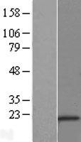 CSDC2 Human Over-expression Lysates NM_014460