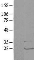 LSM1 Human Over-expression Lysates NM_014462