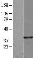 SULT1B1 Human Over-expression Lysates NM_014465
