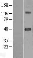 SRPX2 Human Over-expression Lysates NM_014467