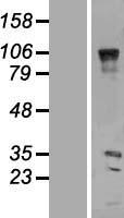 VENTX Human Over-expression Lysates NM_014468