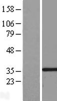 DIMT1L (DIMT1) Human Over-expression Lysates NM_014473