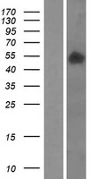 SMPDL3B Human Over-expression Lysates NM_014474