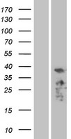 ALP (PDLIM3) Human Over-expression Lysates NM_014476