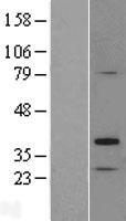 ls027296 tp53tg5 human over expression lysates nm 014477 wb testing 1