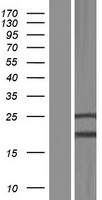 ls027315 pgap2 human over expression lysates nm 001145439 wb testing 2