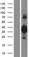 BHLHB5 (BHLHE22) Human Over-expression Lysates NM_152414