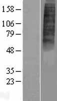 ls027334 p2y10 p2ry10 human over expression lysates nm 014499 wb testing 1