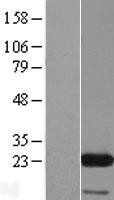 EIF3K Human Over-expression Lysates NM_013234
