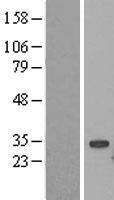 UBE2S Human Over-expression Lysates NM_014501