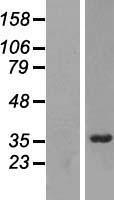 ls027341 rrp7a human over expression lysates nm 015703 wb testing 1