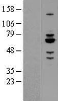 Rabex5 (RABGEF1) Human Over-expression Lysates NM_014504