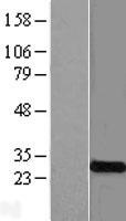 KCNMB4 Human Over-expression Lysates NM_014505