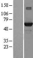 STK39 Human Over-expression Lysates NM_013233