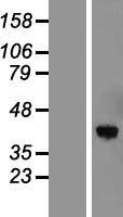 Torsin B (TOR1B) Human Over-expression Lysates NM_014506