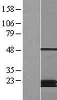 ls027349 mt mcat human over expression lysates nm 014507 wb testing 2