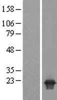 ls027351 pppde2 desi1 human over expression lysates nm 015704 wb testing 1