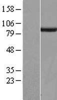 SGSM3 Human Over-expression Lysates NM_015705
