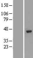 DNA polymerase mu (POLM) Human Over-expression Lysates NM_013284
