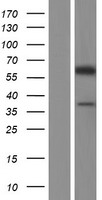 ls027439 tmem121b human over expression lysates nm 031890 wb testing 1