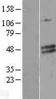 HDHD5 Human Over-expression Lysates NM_033070