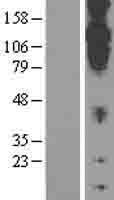 CDH20 Human Over-expression Lysates NM_031891