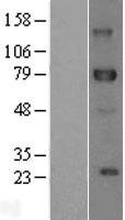 DLL1 Human Over-expression Lysates NM_005618