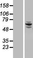 CCDC22 Human Over-expression Lysates NM_014008