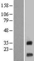 ls028959 tmem176b human over expression lysates nm 014020 wb testing 1