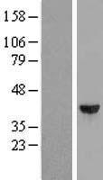 DCPS Human Over-expression Lysates NM_014026