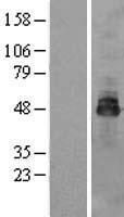 OSTM1 Human Over-expression Lysates NM_014028