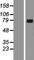 GIT1 Human Over-expression Lysates NM_014030