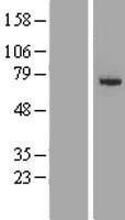 SLC27A6 Human Over-expression Lysates NM_001017372
