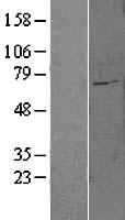 SLC27A6 Human Over-expression Lysates NM_014031