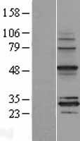 MRPS18B Human Over-expression Lysates NM_014046
