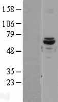 ACAD9 Human Over-expression Lysates NM_014049