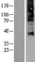 ls028982 flvcr flvcr1 human over expression lysates nm 014053 wb testing 1