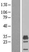 MAGEH1 Human Over-expression Lysates NM_014061