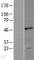 NOB1 Human Over-expression Lysates NM_014062