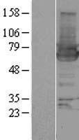 HIP55 (DBNL) Human Over-expression Lysates NM_001014436